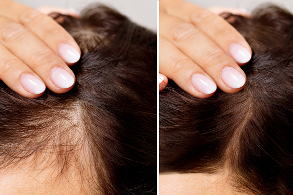 Dermatologist in Chandigarh