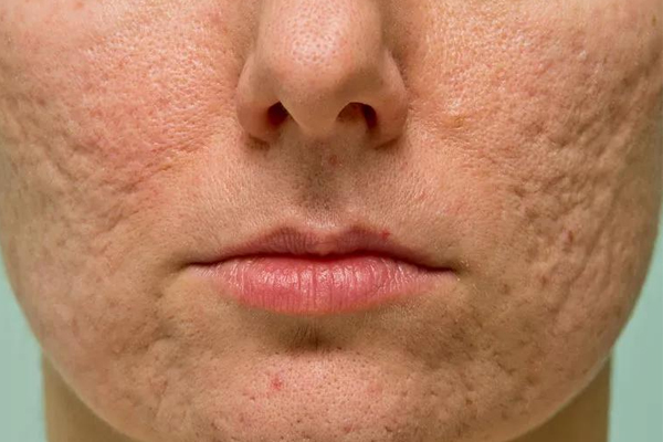 Dermatologist in Chandigarh