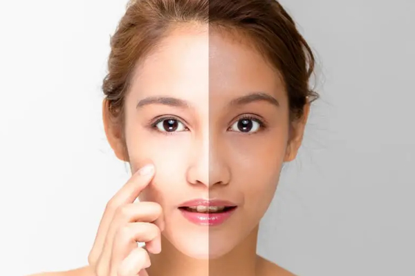 Dermatologist in Chandigarh