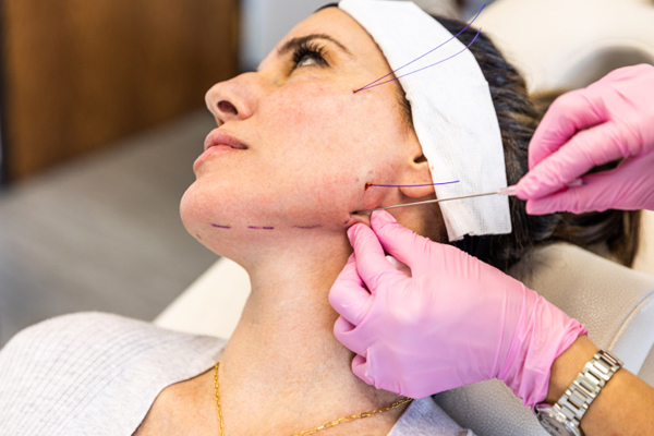 Dermatologist in Chandigarh