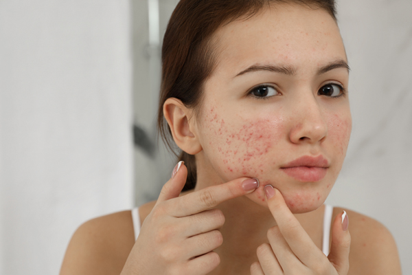 Dermatologist in Chandigarh