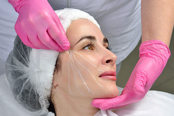 Anti-Aging Treatments Explained: Botox, Fillers, Thread Lifts & More