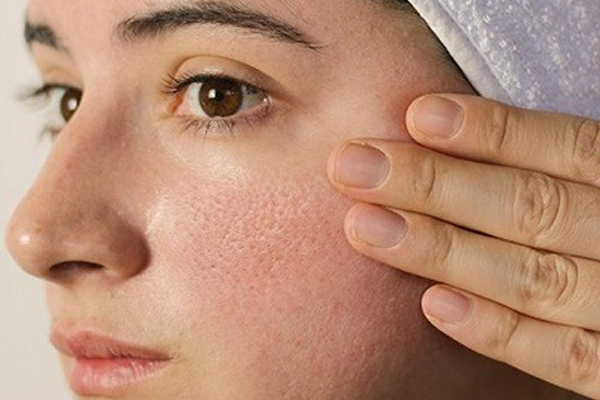 Dermatologist in Chandigarh