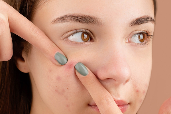 Dermatologist in Chandigarh
