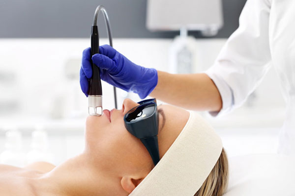 Laser Skin Tightening