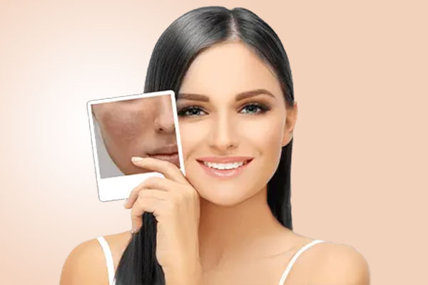Pigmentation Removal: How to Treat Pigmentation