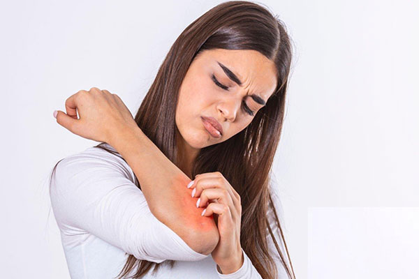 Skin Rashes: What Do Skin Rashes Look Like and How Can You Prevent Them