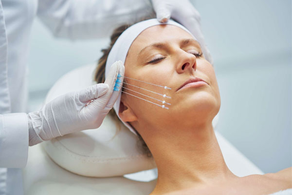 Thread Lifts: How Thread Lifts Can Help